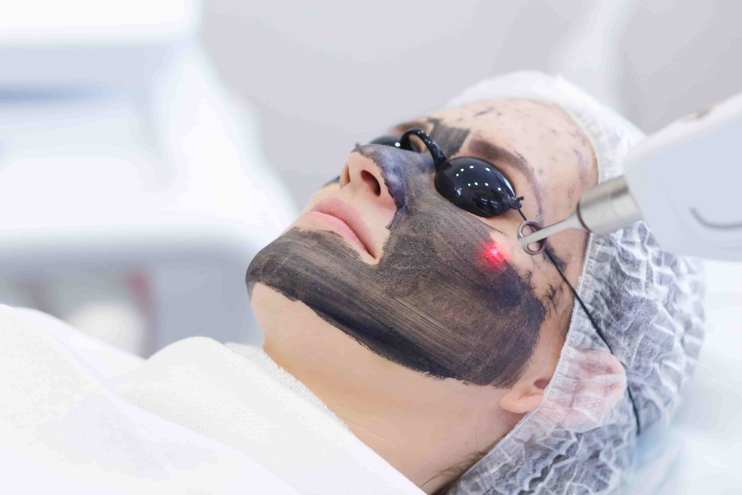 The Carbon Laser Facial An Effective Way to Rejuvenate Your Skin