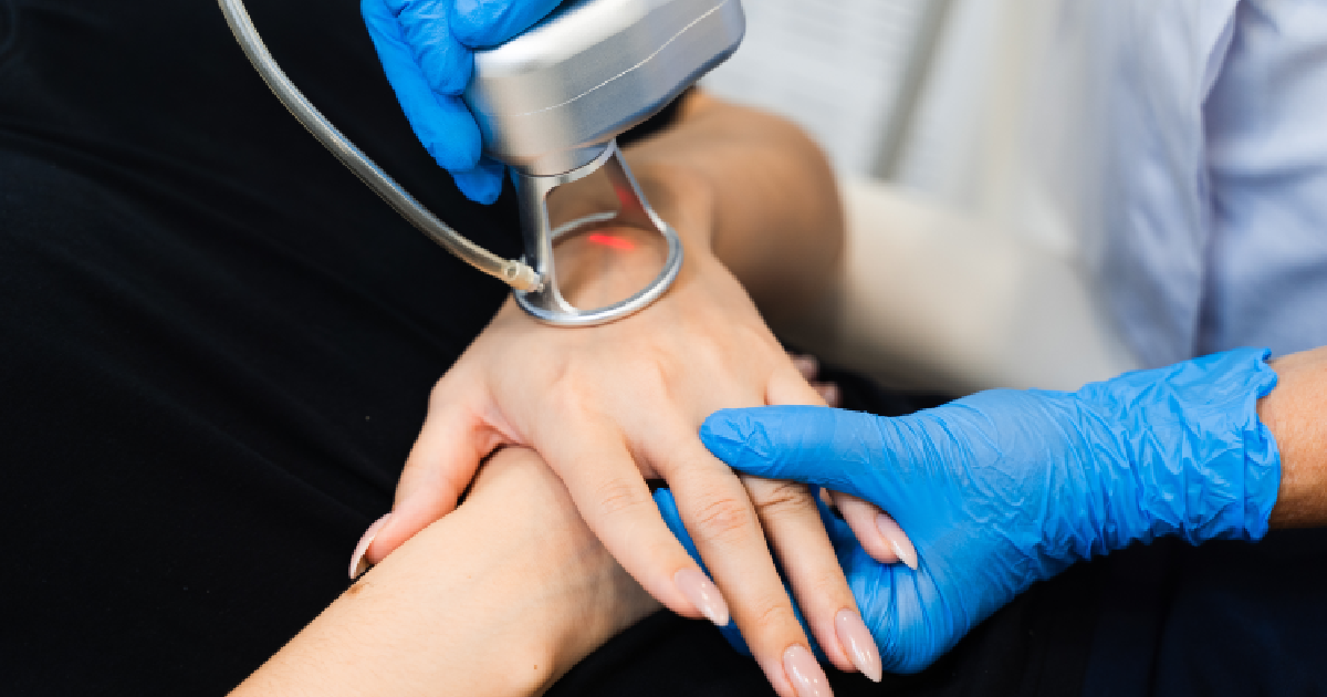 Women receiving CO2 Hand Rejuvenation In Pace, FL