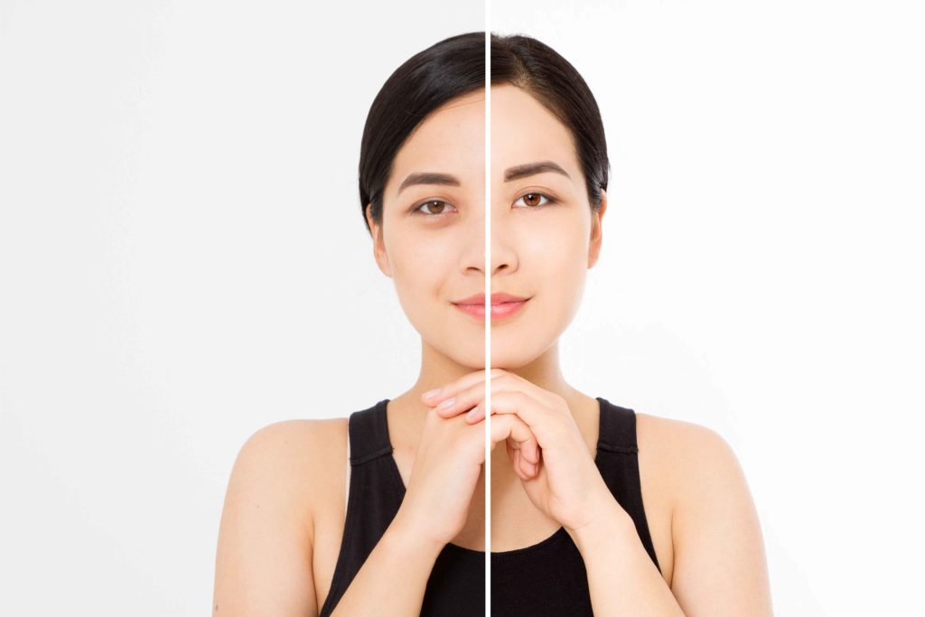 Aerolase Neo Scaled | Skin and Tonic | Pace, Florida, US